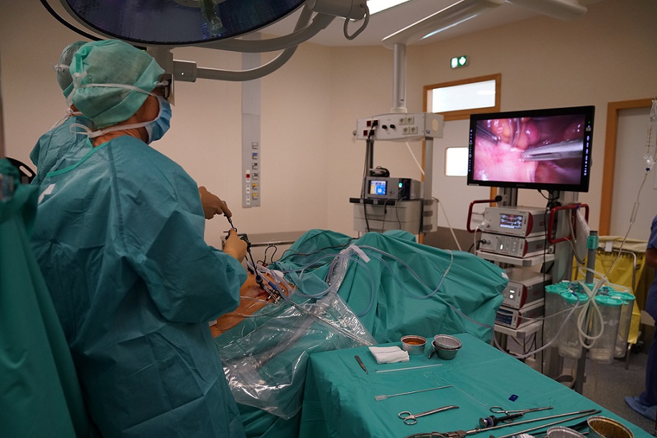 La Chirurgie Coelioscopique C lioscopie laparoscopie En Quoi La Chirurgie Coelioscopique C lioscopie laparoscopie En Quoi